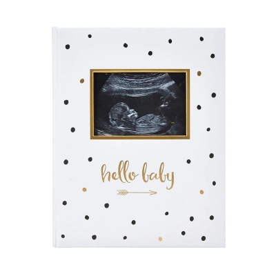 Albúm de Recuerdos Hello Baby